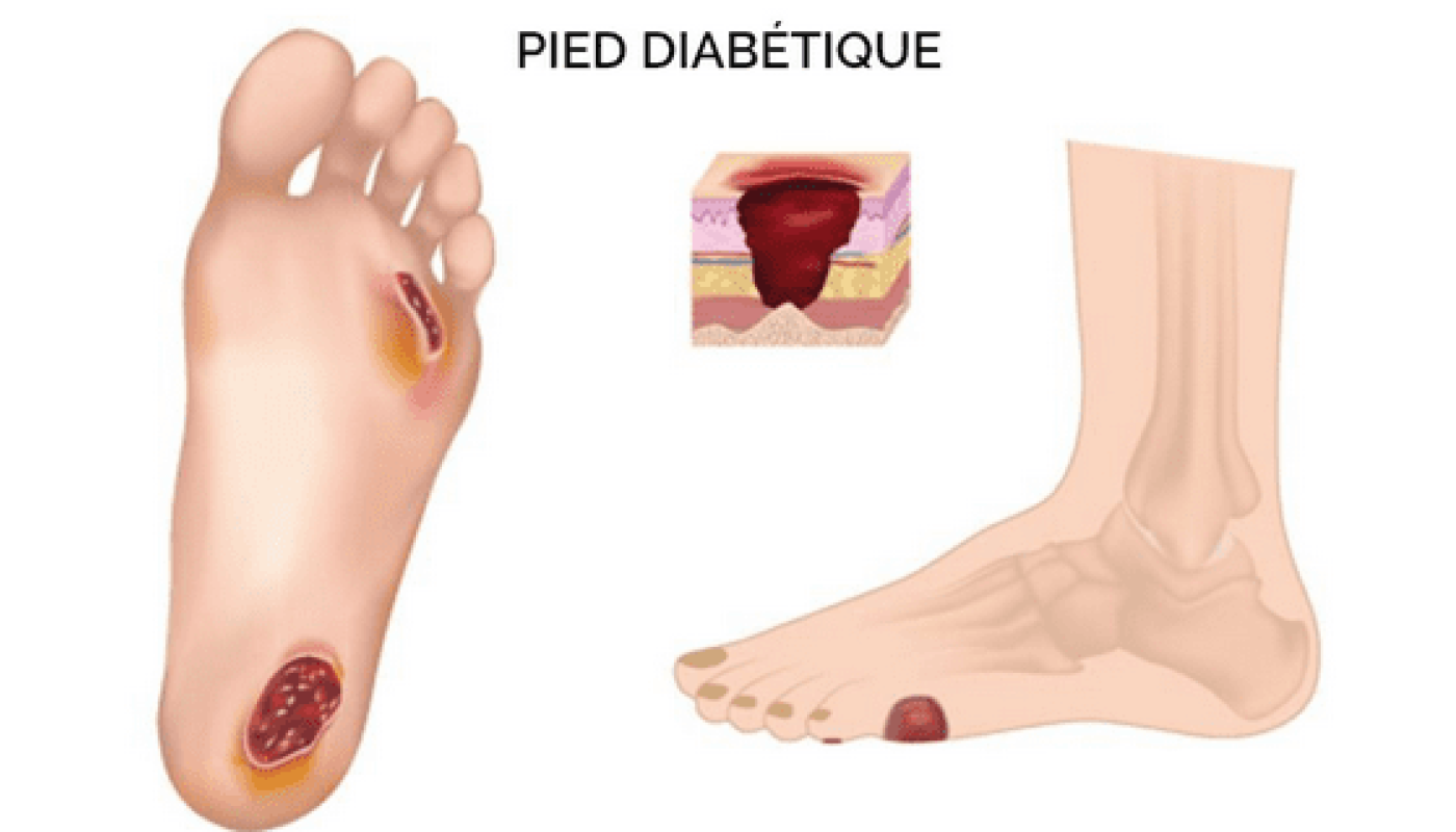 Brevannes Pedi Center