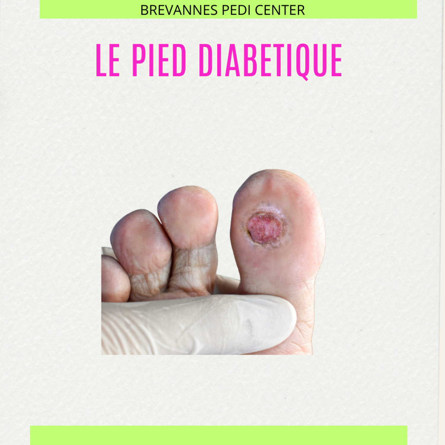 <b>LE PIED DIABÉTIQUE :</b><br>12/12/2026 · 11h00 - 14h00</br>