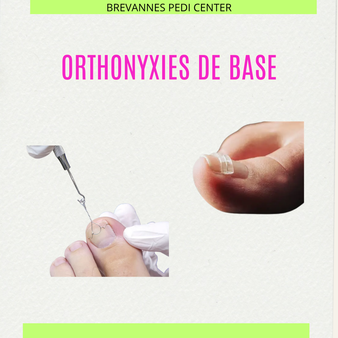 <b>LES ORTHONYXIES DE BASE </b>: <br>07/02/2026 · 11h00 - 17h30</br>