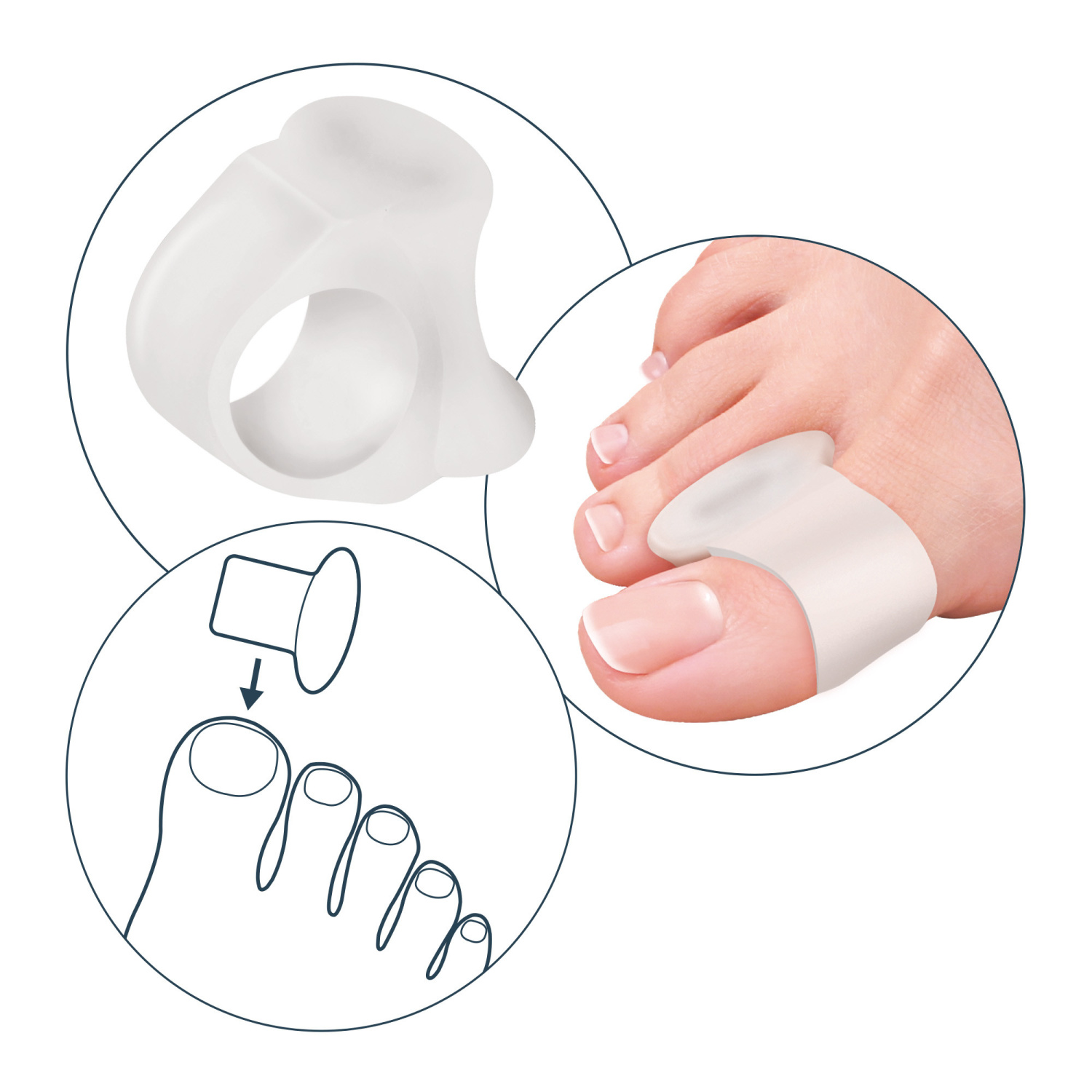 ECARTEUR + ANNEAU EN GEL – Image 2